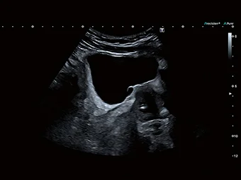 Vizualizare clară a leziunilor de la rinichi la vezică, de la testicul la prostată.