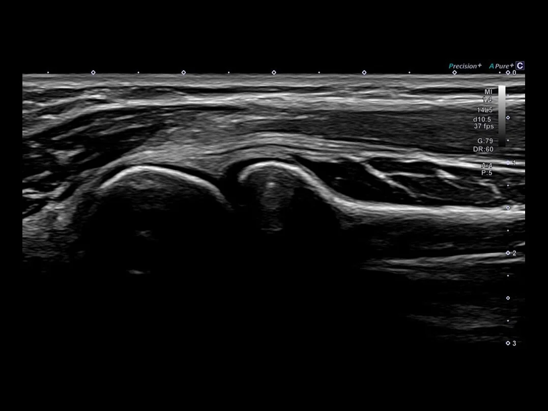 Differential Tissue Imaging (D-THI)