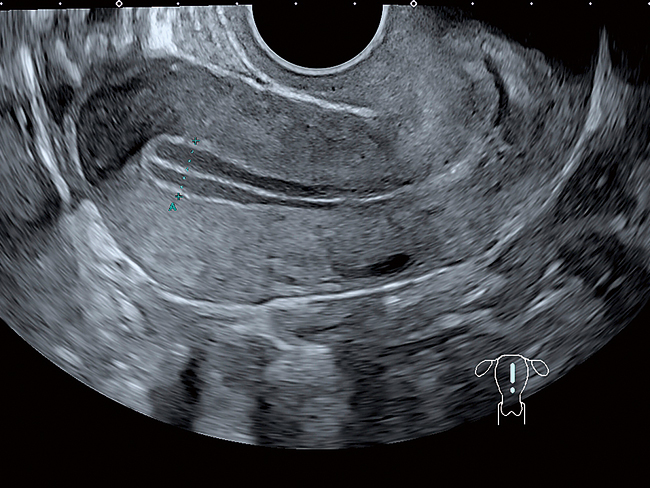 Evaluarea fertilității