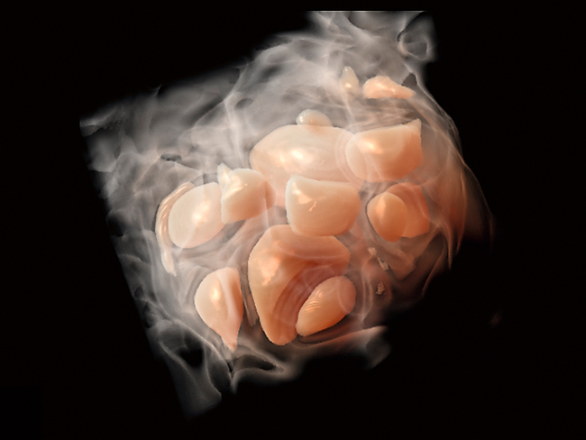 Monitorizarea tratamentului