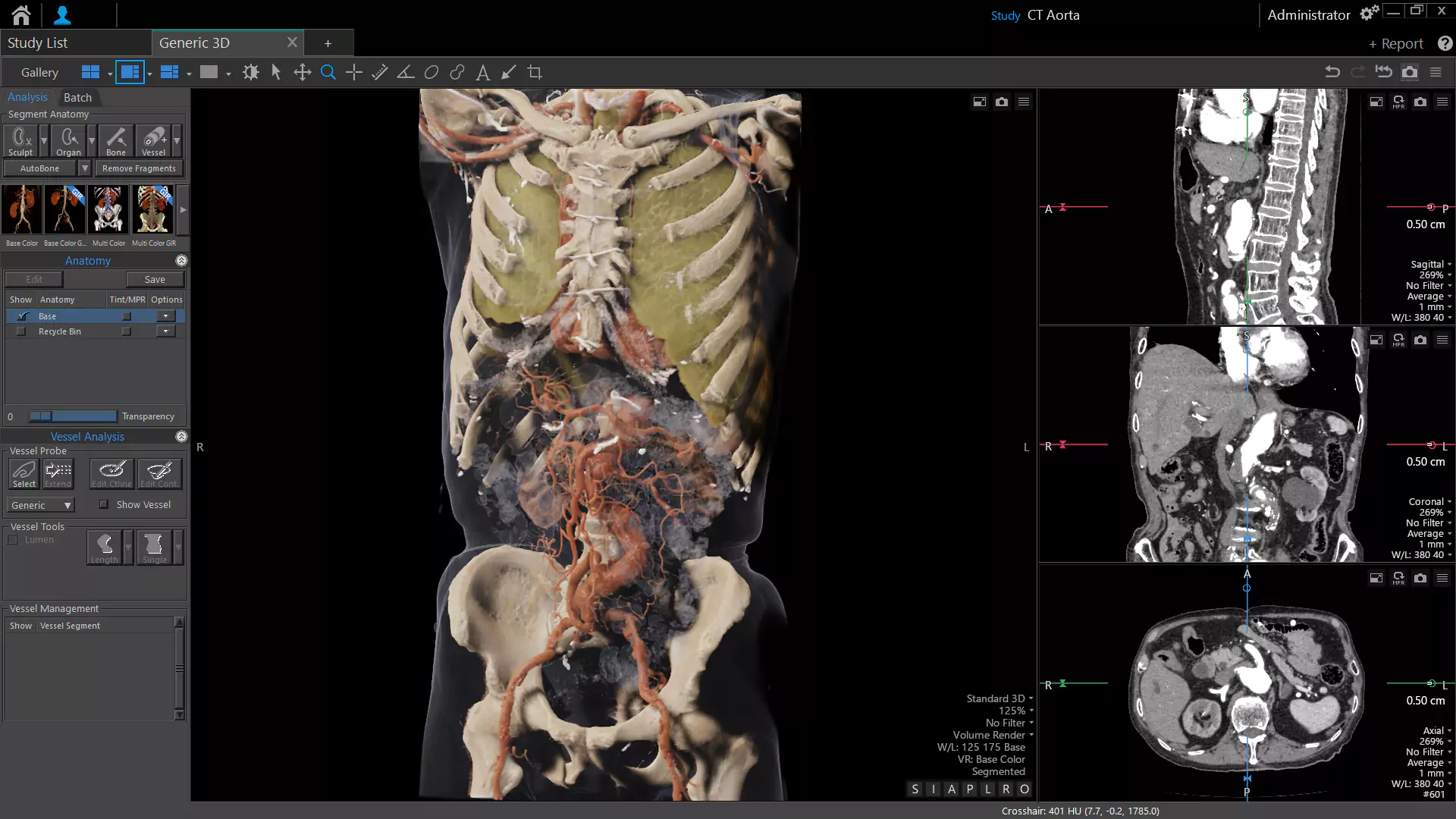 Image of a DICOM