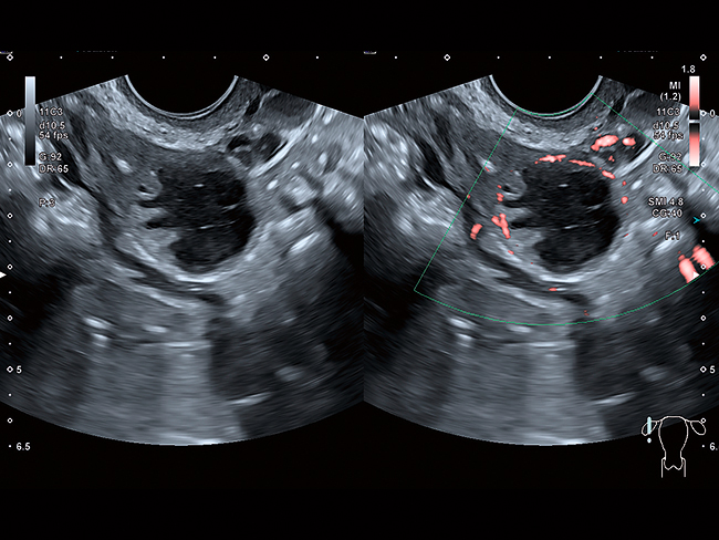 Diagnostic ginecologic precis
