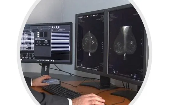 Stație de diagnostic Med Mammo pentru mamografie
