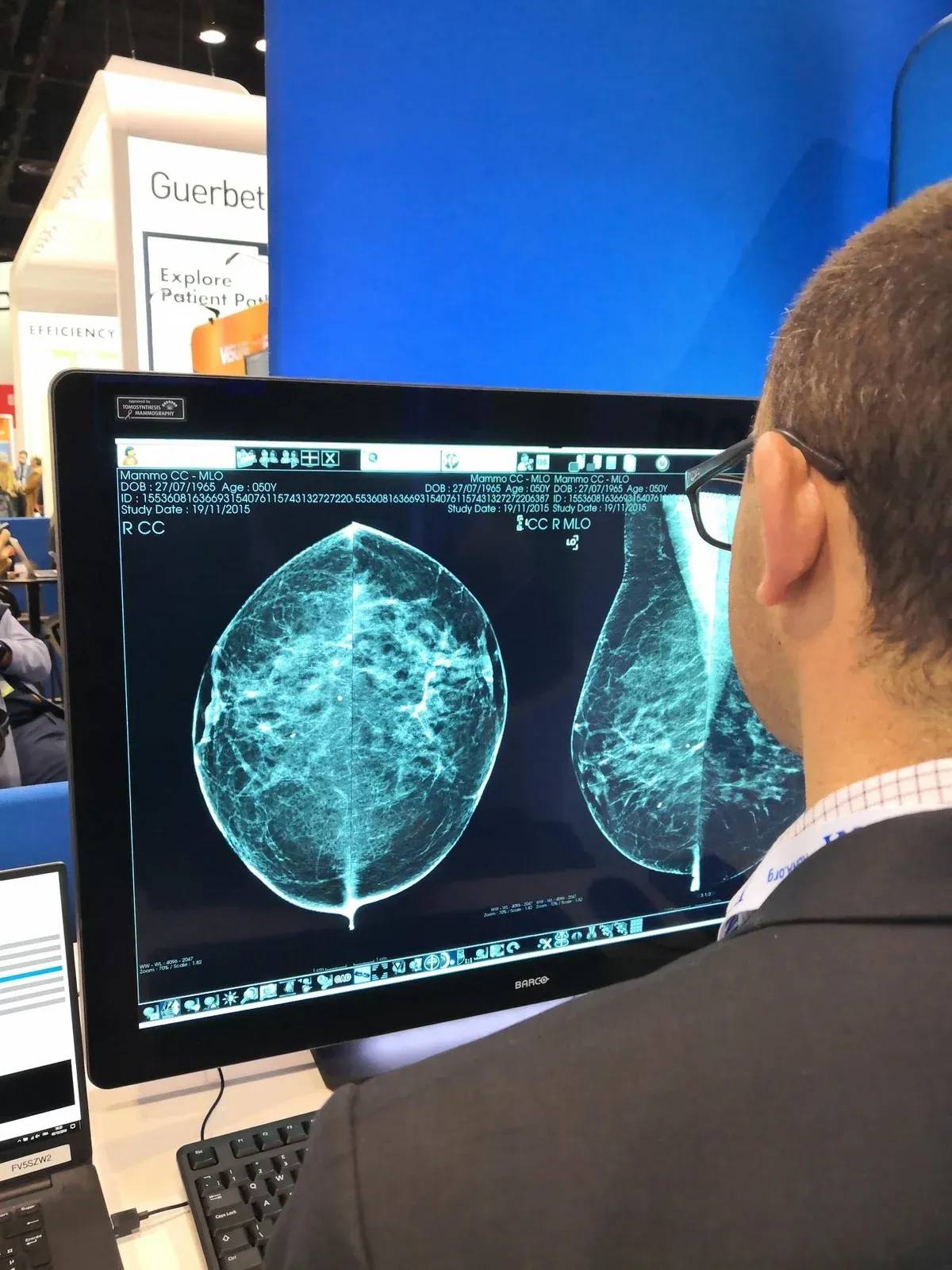 Medic radiolog la stația de diagnostic Med Mammo