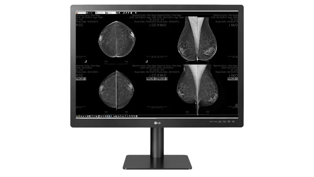 Monitor de 12 MP pentru mamografie