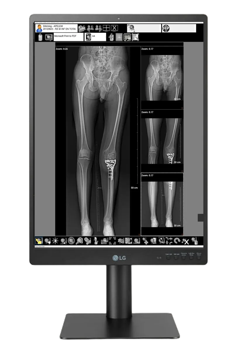 Monitor de 3 MP pentru radiologie