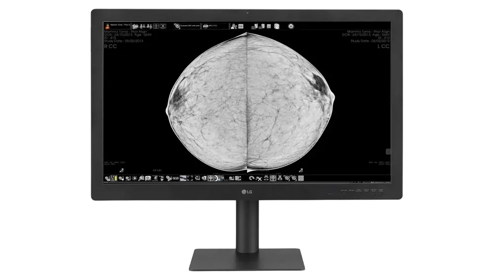 Monitor de 8 MP pentru mamografie