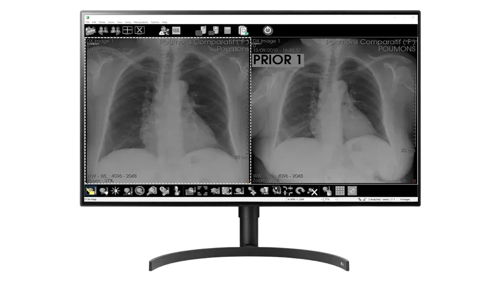 Monitor de 8 MP pentru radiologie
