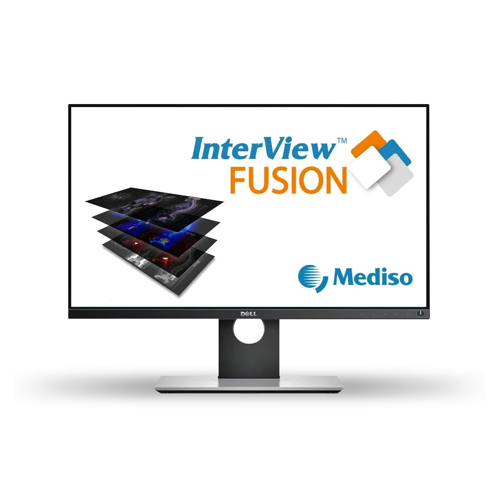 InterView FUSION