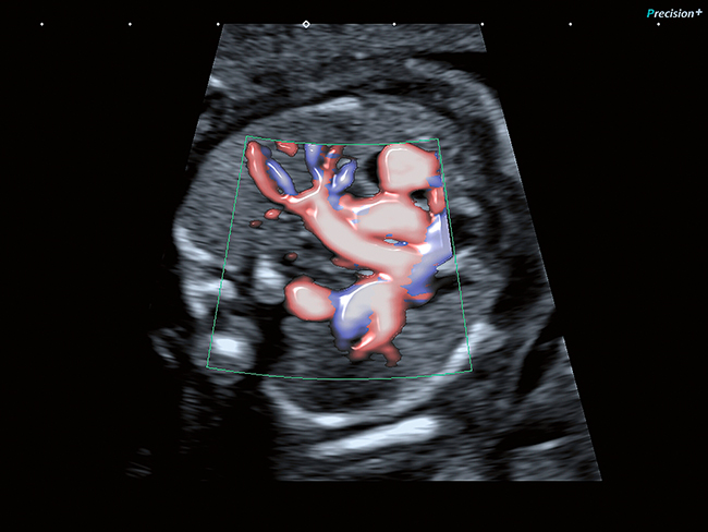 Evaluare fetală avansată