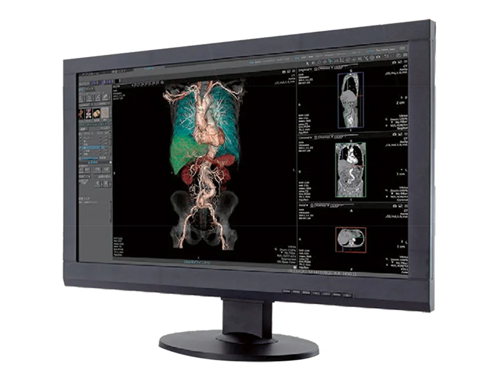 Sisteme IT Medicale Canon