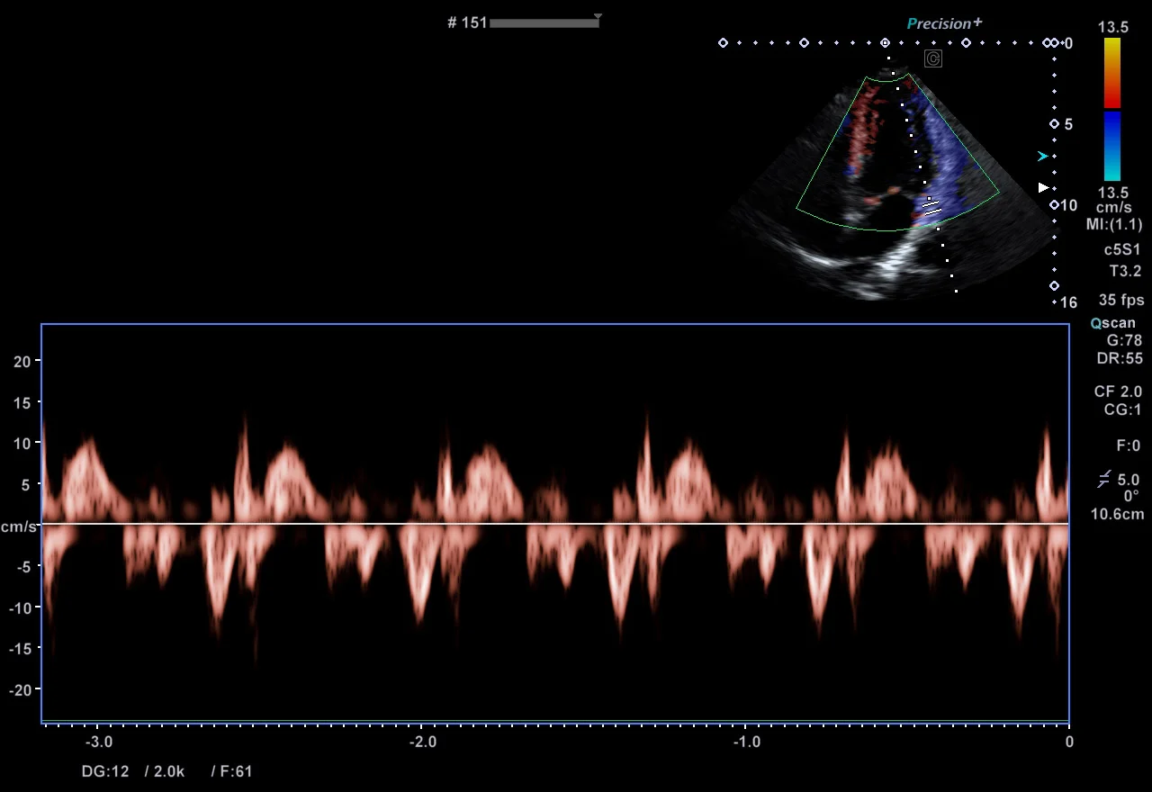 Imagistica Doppler Tisular