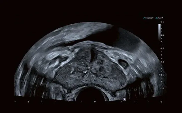 Calitatea imaginii, fără compromisuri, este baza unui diagnostic eficient și a unor biopsii rapide, țintite.