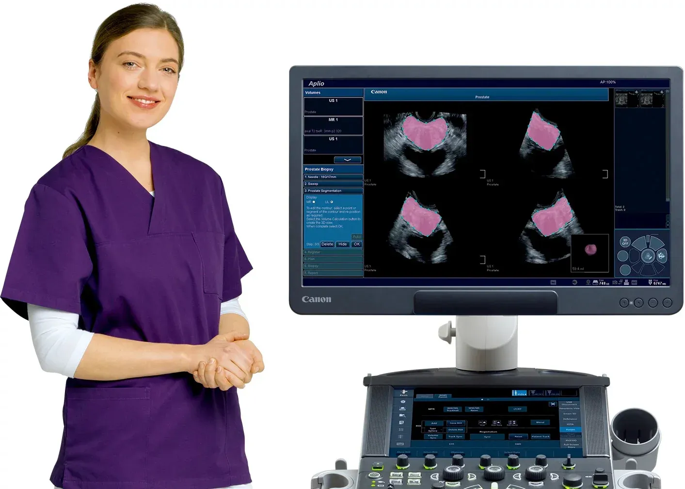 Ecograf Canon Aplio — ergonomie în examinarea urologică